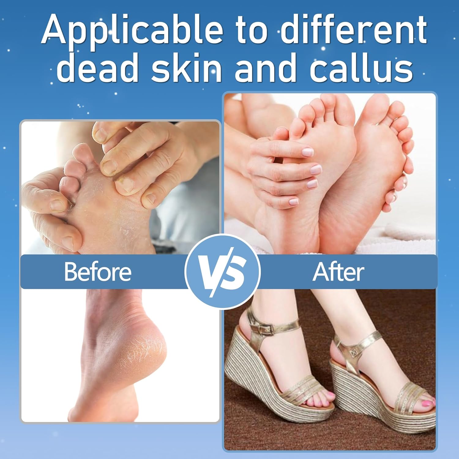 LUVISTI Electric Callus Remover for Feet – Waterproof Rechargeable Foot File with 3 Rollers, 2 Speed Settings, LED Light & 17-in-1 Professional Pedicure Kit for Dead, Hard & Cracked Skin - Image 5